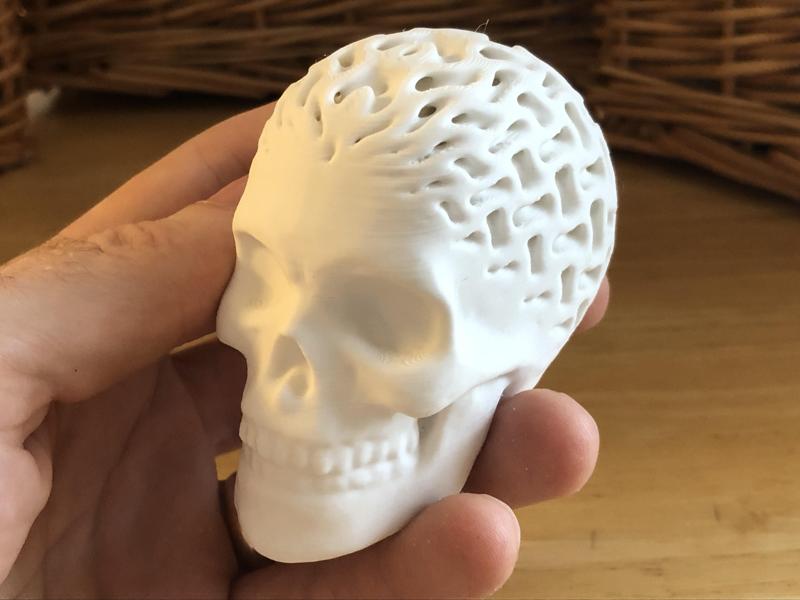 Architected Skull (Gyroid)