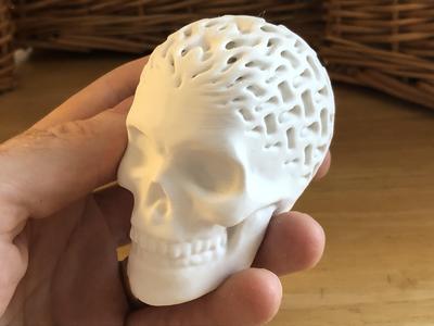 Architected Skull (Gyroid)